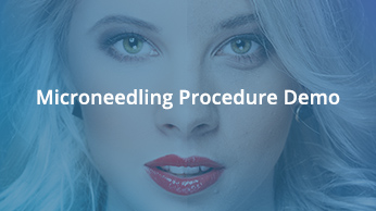 Micro-Needling Procedure Demo