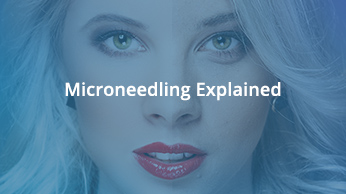 Microneedling explained