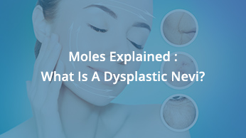 Moles Explained : What Is A Dysplastic Nevi?
