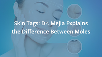 Skin Tags: Dr. Mejia Explains The Difference Between Moles